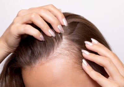 آمپول بیوتین و دکسپانتنول؛ پایان کابوس ریزش مو + راهنمای تزریق